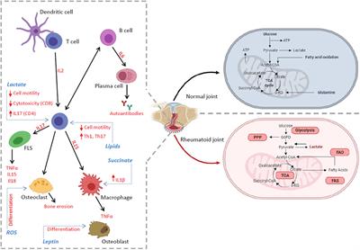 Metabolic Checkpoints in Rheumatoid Arthritis